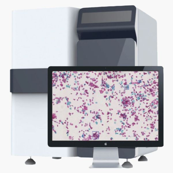 What is digital pathology and how can it help with diagnosis of cancer?